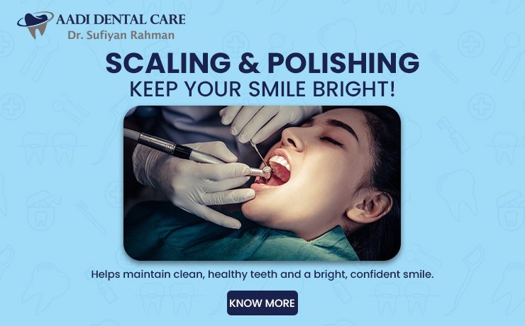 Scaling And Polishing 